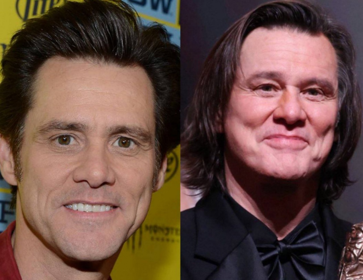 Нижегородский хирург заподозрила Джима Керри в пластической операции - фото 1