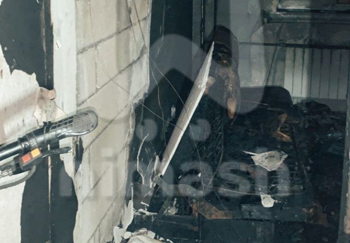 Житель Ждановского получил ожоги из-за взорвавшегося электросамоката - фото 1