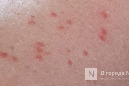 Нижегородцев предупредили о нашествии комаров